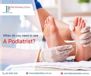 When Do You Need to See Podiatrists in Mandurah?