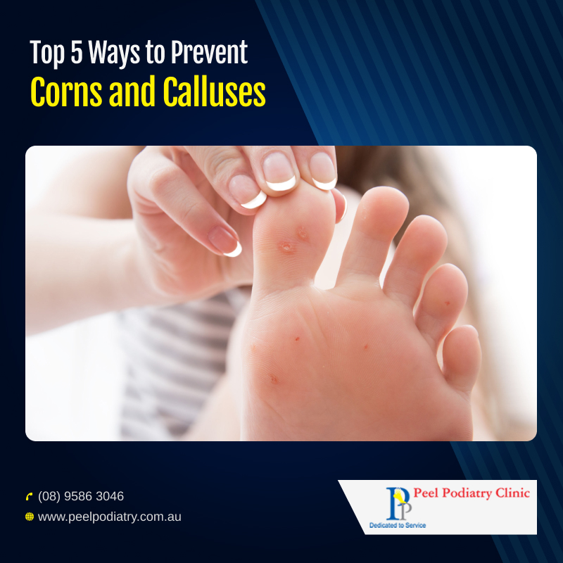 5 Tips to Prevent Calluses and Corns on Toes and Heels - Organic
