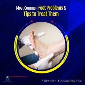 5 Most Common Foot Problems and How to Treat Them