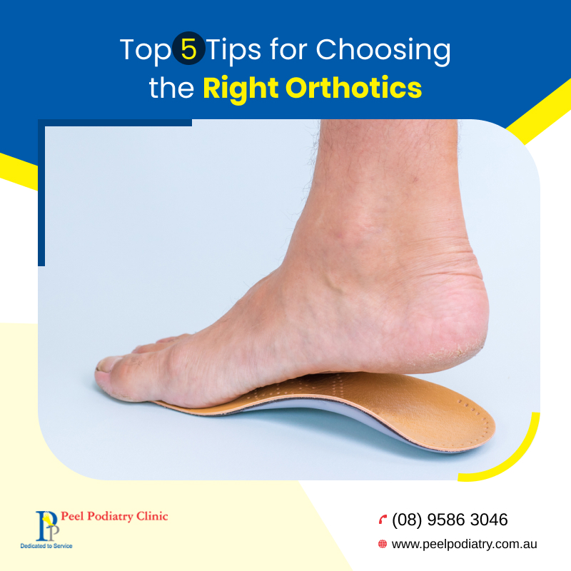 Top 5 Tips on How to Choose the Right Custom Orthotics