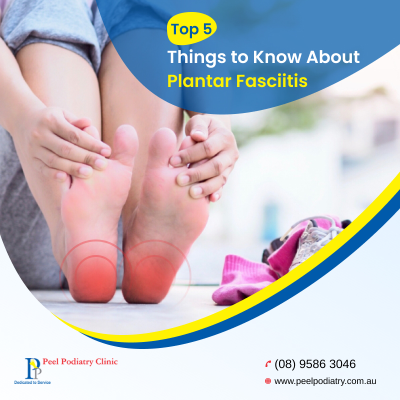 Top 5 Things That You Should Know About Plantar Fasciitis - Peel Podiatry